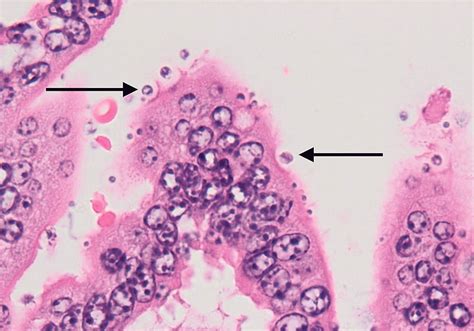  Kryptosporidium: Uma ameba microscópica que causa estragos intestinais em diversos hospedeiros!