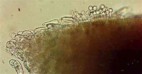  Zoospores!  A Microscopic Marvel That Can Change Shape at Will!